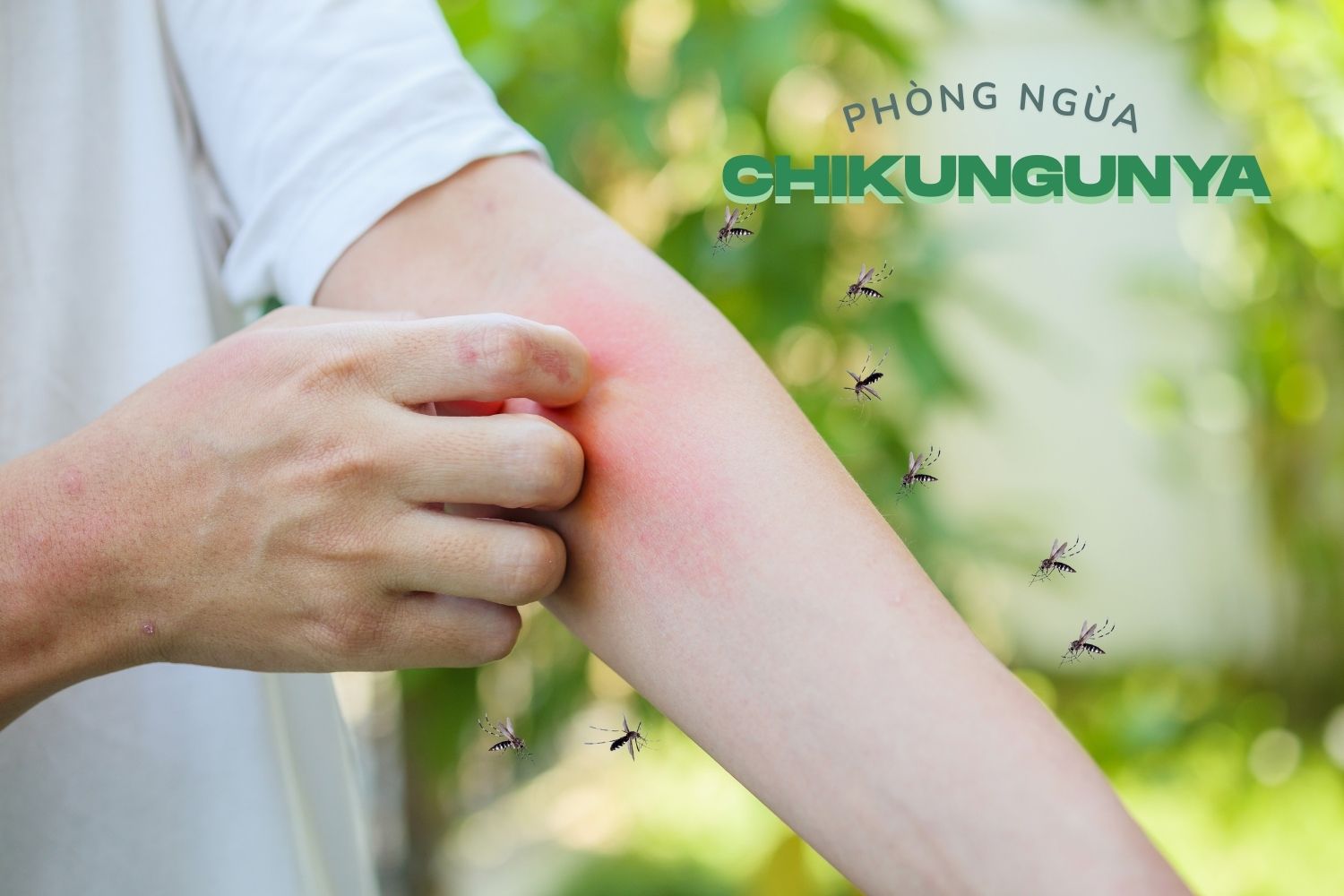 5 món ăn hỗ trợ phòng ngừa Chikungunya