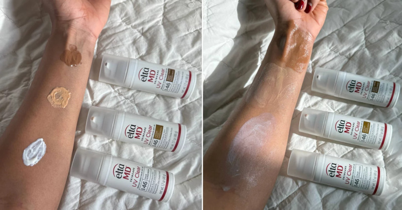 EltaMD chứa Niacinamide giúp làm mờ các vết thâm mụn xuất sắc