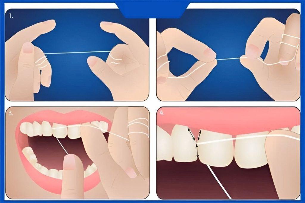 Cách sử dụng chỉ nha khoa dạng cuộn