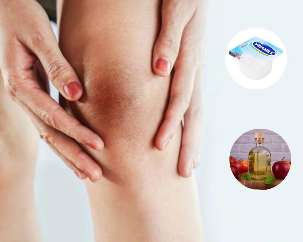 Cách làm trắng da khuỷu tay, đầu gối bằng sữa chua và giấm táo